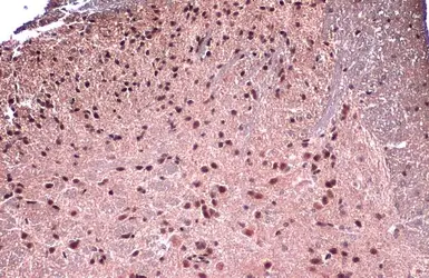 Anti-FOXP1 antibody used in IHC (Paraffin sections) (IHC-P). GTX129252