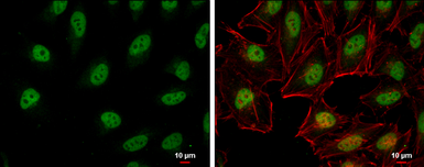 Anti-RFC1 antibody used in Immunocytochemistry/ Immunofluorescence (ICC/IF). GTX129291