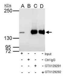 Anti-RFC1 antibody used in Immunoprecipitation (IP). GTX129291