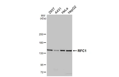 Anti-RFC1 antibody used in Western Blot (WB). GTX129291