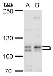 Anti-Cullin 4b antibody used in Western Blot (WB). GTX129298