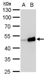 Anti-TIPIN antibody used in Western Blot (WB). GTX129308