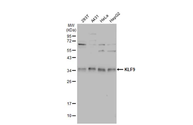 Anti-KLF9 antibody used in Western Blot (WB). GTX129316