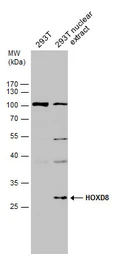 Anti-HOXD8 antibody used in Western Blot (WB). GTX129324