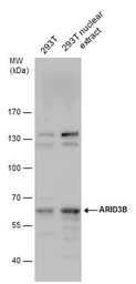 Anti-ARID3B antibody used in Western Blot (WB). GTX129352
