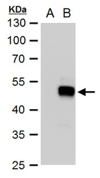 Anti-SOX18 antibody used in Western Blot (WB). GTX129364