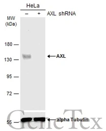 Anti-AXL antibody used in Western Blot (WB). GTX129407