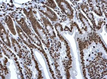 Anti-Histone H2A antibody used in IHC (Paraffin sections) (IHC-P). GTX129418