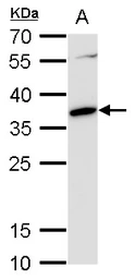 Anti-c-Maf antibody used in Western Blot (WB). GTX129420