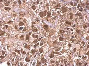 Anti-ARID1A antibody used in IHC (Paraffin sections) (IHC-P). GTX129433