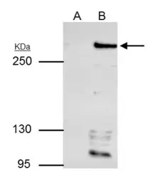 Anti-ARID1A antibody used in Immunoprecipitation (IP). GTX129433
