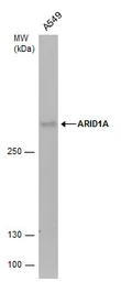 Anti-ARID1A antibody used in Western Blot (WB). GTX129433