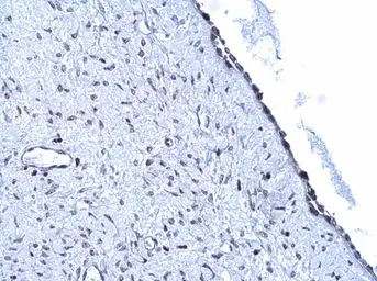 Anti-ARID1A antibody used in IHC (Paraffin sections) (IHC-P). GTX129433