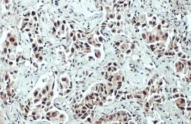 Anti-ARID1A antibody used in IHC (Paraffin sections) (IHC-P). GTX129433