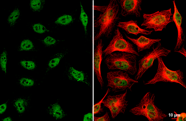 Anti-ARID1A antibody used in Immunocytochemistry/ Immunofluorescence (ICC/IF). GTX129433