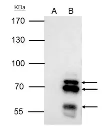 Anti-Ikaros antibody used in Immunoprecipitation (IP). GTX129438
