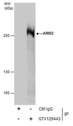 Anti-ARID2 antibody used in Immunoprecipitation (IP). GTX129443