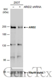 Anti-ARID2 antibody used in Western Blot (WB). GTX129443