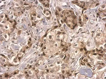 Anti-HMGB2 antibody used in IHC (Paraffin sections) (IHC-P). GTX129464