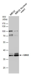 Anti-GBX2 antibody used in Western Blot (WB). GTX129494