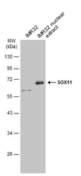 Anti-SOX11 antibody used in Western Blot (WB). GTX129501