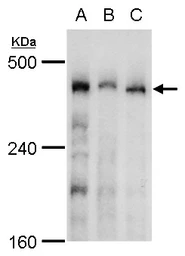 Anti-TRRAP antibody used in Western Blot (WB). GTX129507