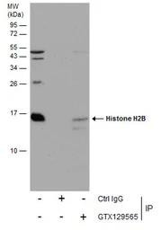 Anti-Histone H2B antibody used in Immunoprecipitation (IP). GTX129565