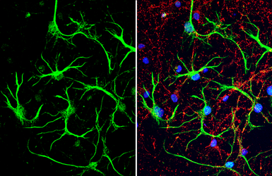 Anti-S100 beta antibody used in Immunocytochemistry/ Immunofluorescence (ICC/IF). GTX129573