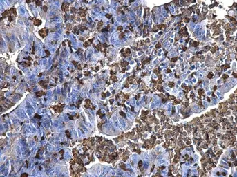 Anti-S100A9 antibody used in IHC (Paraffin sections) (IHC-P). GTX129575