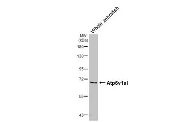 Anti-Atp6v1al antibody used in Western Blot (WB). GTX129736