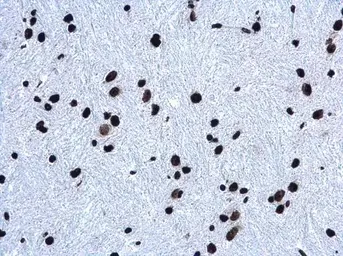 Anti-Histone H3K27me3 (Tri-methyl Lys27) antibody used in IHC (Paraffin sections) (IHC-P). GTX129774