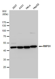 Anti-RNPS1 antibody used in Western Blot (WB). GTX129789
