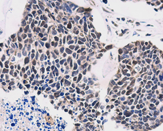 Anti-Transcription Termination Factor 1 antibody used in IHC (Paraffin sections) (IHC-P). GTX129804