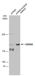 Anti-KDM5D antibody used in Western Blot (WB). GTX129826