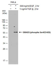Anti-SMAD3 (phospho Ser423/425) antibody used in Western Blot (WB). GTX129841