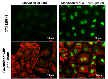 Anti-c-Fos antibody used in Immunocytochemistry/ Immunofluorescence (ICC/IF). GTX129846