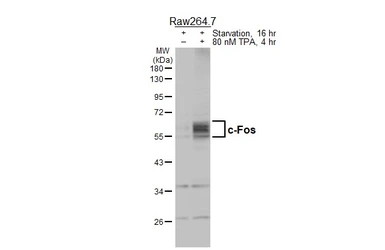 Anti-c-Fos antibody used in Western Blot (WB). GTX129846