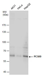 Anti-PCSK9 antibody used in Western Blot (WB). GTX129859