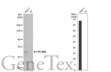 Anti-PCSK9 antibody used in Western Blot (WB). GTX129859