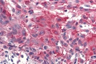 Anti-Frizzled 4 antibody used in IHC (Paraffin sections) (IHC-P). GTX12992
