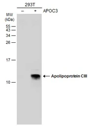 Anti-Apolipoprotein CIII antibody used in Western Blot (WB). GTX129994