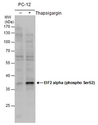 Anti-eIF2 alpha (phospho Ser51) antibody used in Western Blot (WB). GTX130006