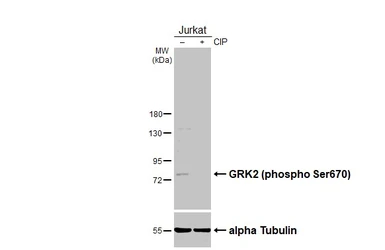 Anti-GRK2 (phospho Ser670) antibody used in Western Blot (WB). GTX130007