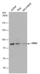 Anti-GRK2 antibody used in Western Blot (WB). GTX130012