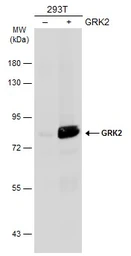 Anti-GRK2 antibody used in Western Blot (WB). GTX130012