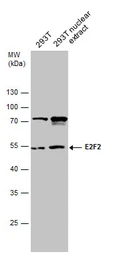 Anti-E2F2 antibody used in Western Blot (WB). GTX130030