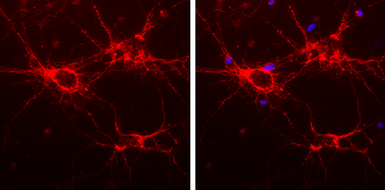 Anti-alpha Internexin antibody used in Immunocytochemistry/ Immunofluorescence (ICC/IF). GTX130053