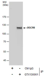 Anti-DGCR8 antibody used in Immunoprecipitation (IP). GTX130061
