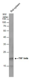 Anti-TNF beta antibody used in Western Blot (WB). GTX130100