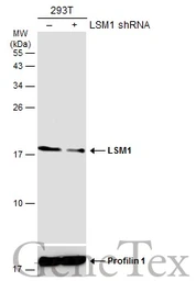 Anti-LSM1 antibody used in Western Blot (WB). GTX130104